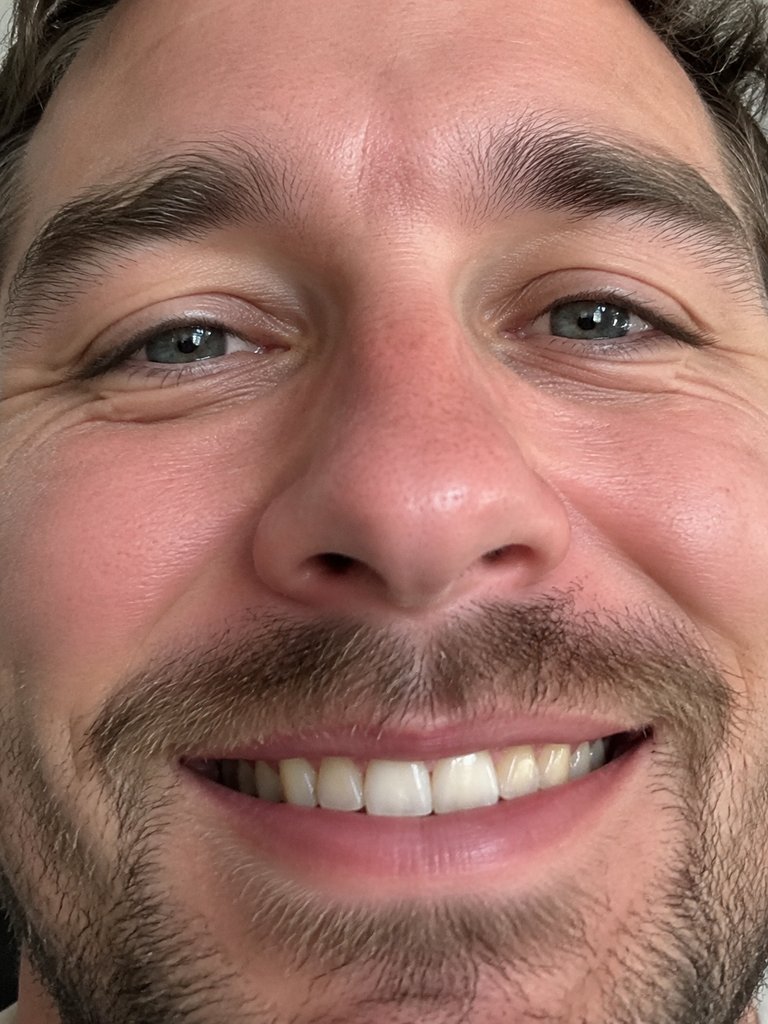 Extreme close-up of a face with no shoulders or hands in frame